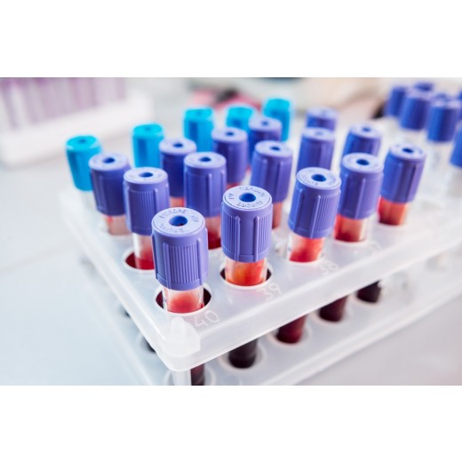 Arun Test Two Product